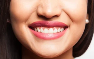 Persona con tratamiento de blanqueamiento de dientes